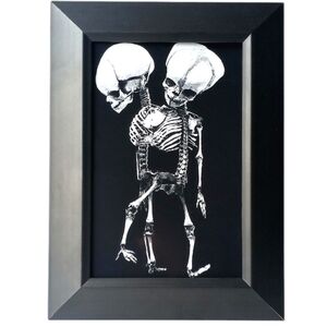 Conjoined Twins Sideshow FreakShow Oddity Freakshow Side Show Oddities Goth Art
